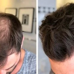 Beste recensies van ???? IMPERIO Premium Haarvezels Donkerbruin - Kaalheid Mannen - Alopecia Vrouwen - 100% Onzichtbaar ???? 37 Beste recensies van ???? IMPERIO Premium Haarvezels Donkerbruin - Kaalheid Mannen - Alopecia Vrouwen - 100% Onzichtbaar ???? -Weleda Shop 550x297
