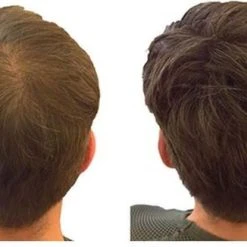 Beste recensies van ???? IMPERIO Premium Haarvezels Donkerbruin - Kaalheid Mannen - Alopecia Vrouwen - 100% Onzichtbaar ???? 36 Beste recensies van ???? IMPERIO Premium Haarvezels Donkerbruin - Kaalheid Mannen - Alopecia Vrouwen - 100% Onzichtbaar ???? -Weleda Shop 550x326 1