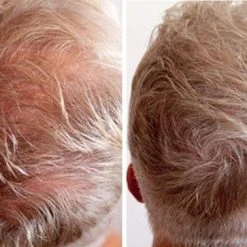 Beste recensies van ???? IMPERIO Premium Haarvezels Donkerbruin - Kaalheid Mannen - Alopecia Vrouwen - 100% Onzichtbaar ???? 39 Beste recensies van ???? IMPERIO Premium Haarvezels Donkerbruin - Kaalheid Mannen - Alopecia Vrouwen - 100% Onzichtbaar ???? -Weleda Shop 550x363