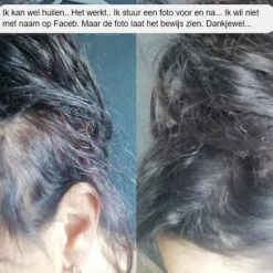 Beste recensies van ???? IMPERIO Premium Haarvezels Donkerbruin - Kaalheid Mannen - Alopecia Vrouwen - 100% Onzichtbaar ???? 31 Beste recensies van ???? IMPERIO Premium Haarvezels Donkerbruin - Kaalheid Mannen - Alopecia Vrouwen - 100% Onzichtbaar ???? -Weleda Shop 550x366 9