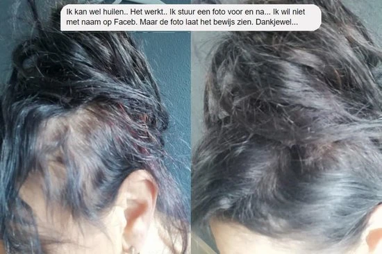 Beste recensies van ???? IMPERIO Premium Haarvezels Donkerbruin - Kaalheid Mannen - Alopecia Vrouwen - 100% Onzichtbaar ???? 10 Beste recensies van ???? IMPERIO Premium Haarvezels Donkerbruin - Kaalheid Mannen - Alopecia Vrouwen - 100% Onzichtbaar ???? - Afbeelding 10