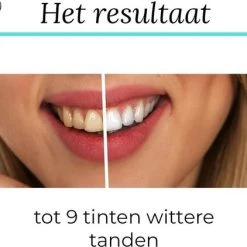 Groothandel ???? SmileKit Teeth Whitening Strips - Tanden Bleken - Tandenbleekset - Tandenbleek Strips - 100% Natuurlijk/Vegan - 28x Tandenbleek Strips - (0%) Peroxide - Activated Houtskool & Kokosolie - Beauty - Frisse Adem ???? 12 Groothandel ???? SmileKit Teeth Whitening Strips - Tanden Bleken - Tandenbleekset - Tandenbleek Strips - 100% Natuurlijk/Vegan - 28x Tandenbleek Strips - (0%) Peroxide - Activated Houtskool & Kokosolie - Beauty - Frisse Adem ???? -Weleda Shop 550x422 1