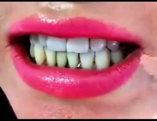 Groothandel ???? SmileKit Teeth Whitening Strips - Tanden Bleken - Tandenbleekset - Tandenbleek Strips - 100% Natuurlijk/Vegan - 28x Tandenbleek Strips - (0%) Peroxide - Activated Houtskool & Kokosolie - Beauty - Frisse Adem ???? 2 Groothandel ???? SmileKit Teeth Whitening Strips - Tanden Bleken - Tandenbleekset - Tandenbleek Strips - 100% Natuurlijk/Vegan - 28x Tandenbleek Strips - (0%) Peroxide - Activated Houtskool & Kokosolie - Beauty - Frisse Adem ???? - Afbeelding 2