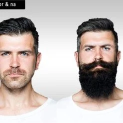 Flash-uitverkoop ⌛ LB Products™ Baardgroei Olie + Derma Baard Roller - 30 Ml ???? -Weleda Shop 550x438 3