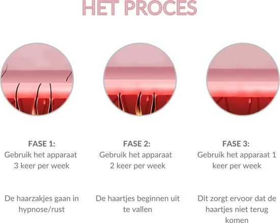 Korting ???? P'eau Hairremoval Peau Premium Ontharingsapparaat - IPL Ontharing Laser - Rosé ???? 8 Korting ???? P'eau Hairremoval Peau Premium Ontharingsapparaat - IPL Ontharing Laser - Rosé ???? - Afbeelding 8
