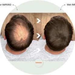 Beste recensies van ???? IMPERIO Premium Haarvezels Donkerbruin - Kaalheid Mannen - Alopecia Vrouwen - 100% Onzichtbaar ???? 30 Beste recensies van ???? IMPERIO Premium Haarvezels Donkerbruin - Kaalheid Mannen - Alopecia Vrouwen - 100% Onzichtbaar ???? -Weleda Shop 550x463 1