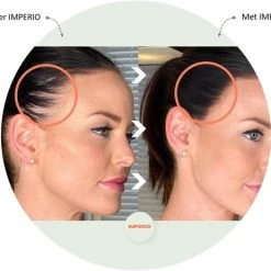 Beste recensies van ???? IMPERIO Premium Haarvezels Donkerbruin - Kaalheid Mannen - Alopecia Vrouwen - 100% Onzichtbaar ???? 29 Beste recensies van ???? IMPERIO Premium Haarvezels Donkerbruin - Kaalheid Mannen - Alopecia Vrouwen - 100% Onzichtbaar ???? -Weleda Shop 550x463