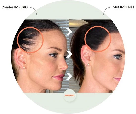 Beste recensies van ???? IMPERIO Premium Haarvezels Donkerbruin - Kaalheid Mannen - Alopecia Vrouwen - 100% Onzichtbaar ???? 8 Beste recensies van ???? IMPERIO Premium Haarvezels Donkerbruin - Kaalheid Mannen - Alopecia Vrouwen - 100% Onzichtbaar ???? - Afbeelding 8