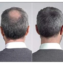 Beste recensies van ???? IMPERIO Premium Haarvezels Donkerbruin - Kaalheid Mannen - Alopecia Vrouwen - 100% Onzichtbaar ???? 33 Beste recensies van ???? IMPERIO Premium Haarvezels Donkerbruin - Kaalheid Mannen - Alopecia Vrouwen - 100% Onzichtbaar ???? -Weleda Shop 550x465 5