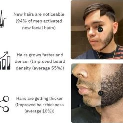 Korting ✨ Dalto Grooming Baardgroei Kit - Baard - Baardgroei Stimuleren - Dermaroller - Huidverzorging - Baardverzorging Set - Baardgroei Kit - Baardgroei - Skin Roller ???? 25 Korting ✨ Dalto Grooming Baardgroei Kit - Baard - Baardgroei Stimuleren - Dermaroller - Huidverzorging - Baardverzorging Set - Baardgroei Kit - Baardgroei - Skin Roller ???? -Weleda Shop 550x488 4