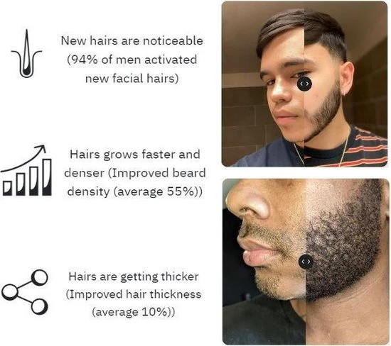 Korting ✨ Dalto Grooming Baardgroei Kit - Baard - Baardgroei Stimuleren - Dermaroller - Huidverzorging - Baardverzorging Set - Baardgroei Kit - Baardgroei - Skin Roller ???? 7 Korting ✨ Dalto Grooming Baardgroei Kit - Baard - Baardgroei Stimuleren - Dermaroller - Huidverzorging - Baardverzorging Set - Baardgroei Kit - Baardgroei - Skin Roller ???? - Afbeelding 7