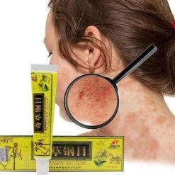 Promo ???? Bangrui Psoriasis/exzeem Chineese Creme ????
