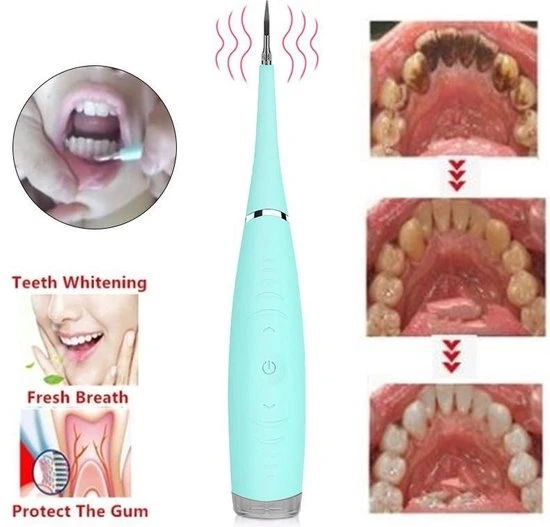 Beste recensies van ???? Fitopia Tandsteen Verwijderaar - Elektrisch - Handmatig Tandplak Verwijderen - Ultrasonic Tooth Cleaning - Blauw & Roze ???? 2 Beste recensies van ???? Fitopia Tandsteen Verwijderaar - Elektrisch - Handmatig Tandplak Verwijderen - Ultrasonic Tooth Cleaning - Blauw & Roze ???? - Afbeelding 2