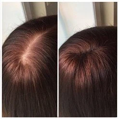 Beste recensies van ???? IMPERIO Premium Haarvezels Donkerbruin - Kaalheid Mannen - Alopecia Vrouwen - 100% Onzichtbaar ???? 41 Beste recensies van ???? IMPERIO Premium Haarvezels Donkerbruin - Kaalheid Mannen - Alopecia Vrouwen - 100% Onzichtbaar ???? -Weleda Shop 550x550 117