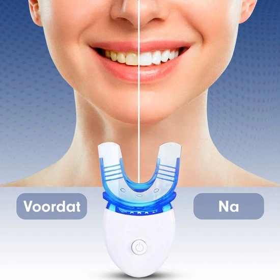 Beste Verkoop ???? Imperatoris Diamond White | Tandenbleekset– Inclusief Teeth Whitening Strips - Tandenbleek Strips – 3D LED – Wittere Tanden ???? 9 Beste Verkoop ???? Imperatoris Diamond White | Tandenbleekset– Inclusief Teeth Whitening Strips - Tandenbleek Strips – 3D LED – Wittere Tanden ???? - Afbeelding 9