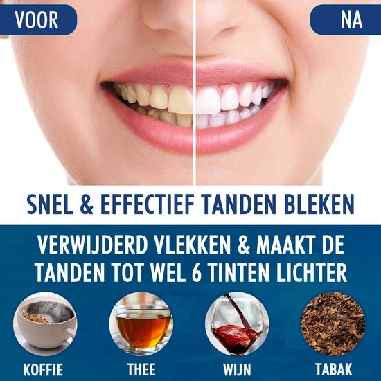 Beste recensies van ⌛ Southland Tandenbleekset - Tandenblekers - Whitening Strips - Teeth Whitening - Tanden Bleken ⭐ 2 Beste recensies van ⌛ Southland Tandenbleekset - Tandenblekers - Whitening Strips - Teeth Whitening - Tanden Bleken ⭐ - Afbeelding 2