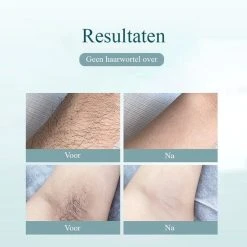 Goedkoop ???? Flowfull IPL Ontharingsapparaat – Met GRATIS Beschermbril En Scheermesje- Pijnloos ???? -Weleda Shop 550x550 442