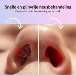 Flash-uitverkoop ???? Rivema Luxe Wax Ontharing Set – Neus Ontharing – Wax Beans – Ontharingswax – Ontharen – 7 Maanden Haarvrij ???? -Weleda Shop 550x550 50