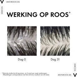 Flash-uitverkoop ✨ Vichy Dercos Anti-Roos Shampoo Voor Droog Haar - 200ml ???? -Weleda Shop 550x552 10