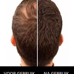 Flash-uitverkoop ???? Sevich Haarpoeder Voor Zwart Haar - Hoge Kwaliteit Camouflage Voor Kale Plekken - Haarverdikker - Organic - Hair Fiber Building ???? 5 Flash-uitverkoop ???? Sevich Haarpoeder Voor Zwart Haar - Hoge Kwaliteit Camouflage Voor Kale Plekken - Haarverdikker - Organic - Hair Fiber Building ???? -Weleda Shop 550x649 2