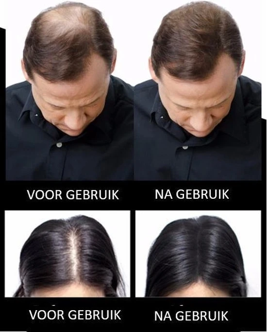 Flash-uitverkoop ???? Sevich Haarpoeder Voor Zwart Haar - Hoge Kwaliteit Camouflage Voor Kale Plekken - Haarverdikker - Organic - Hair Fiber Building ???? 2 Flash-uitverkoop ???? Sevich Haarpoeder Voor Zwart Haar - Hoge Kwaliteit Camouflage Voor Kale Plekken - Haarverdikker - Organic - Hair Fiber Building ???? - Afbeelding 2